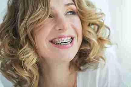 Is Invisalign Painful? What Does It Feel Like?