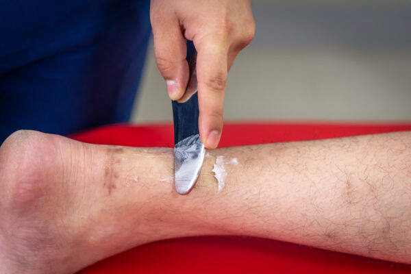 Unlocking the Power of Hydrogel Dressings in Chronic Wound Healing Advanced Wound Care Solutions