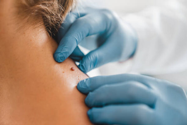 What’s the Process for Renewing a DOT Physical Card? DOT physical exams clinic